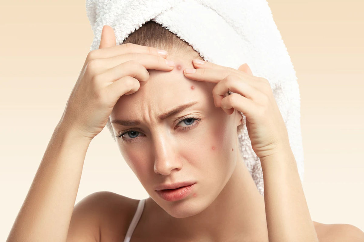 Beauty Remedies: चेहरे पर लगाएं प्याज में शहद मिलाकर, दाग-धब्बों से मिलेगा छुटकारा