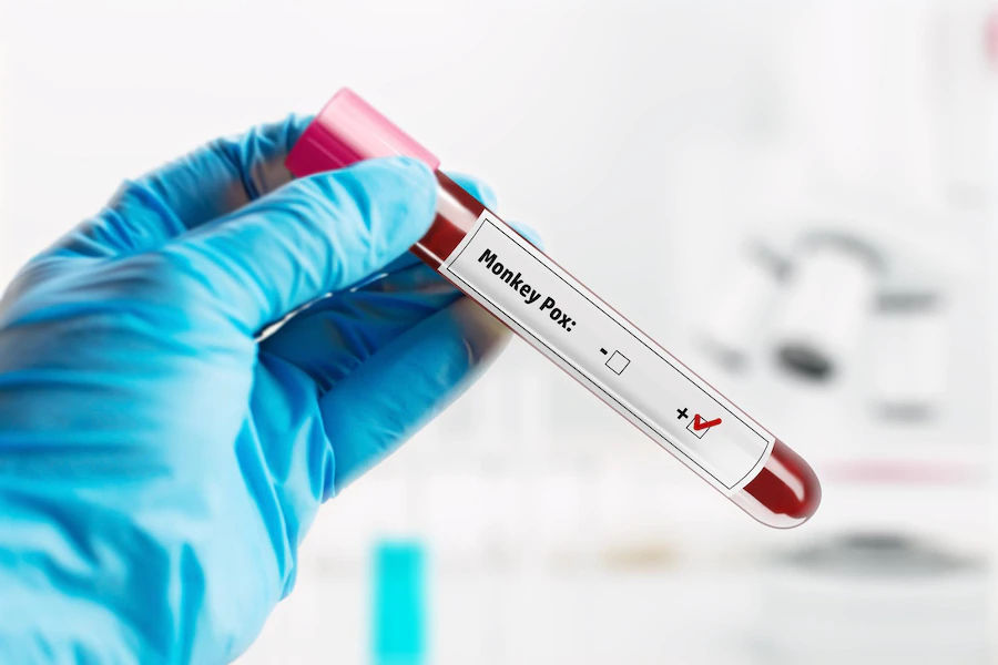 अब घर बैठे कर सकेंगे Monkeypox की जांच, लॉन्च हुई नई RT-PCR किट