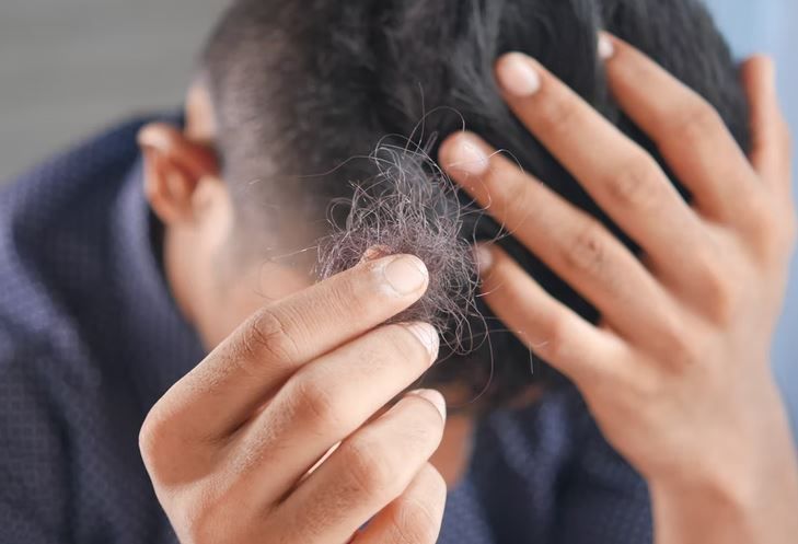 एक दिन में कितना Hair Loss होता है नॉर्मल, जानें कब-कब झड़ते है आपके बाल