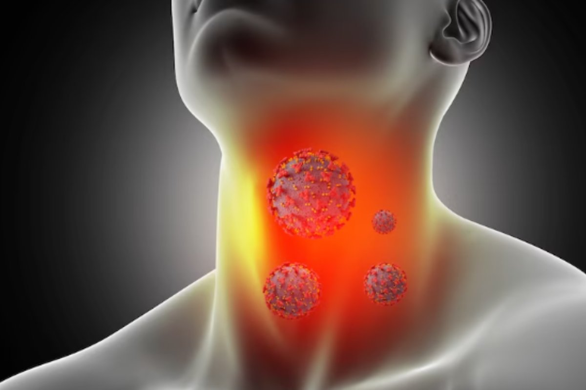 Throat Cancer Symptoms: गले का कैंसर होने पर मिलते हैं ये 6 संकेत, जल्द ध्यान देने से बच सकती है जान