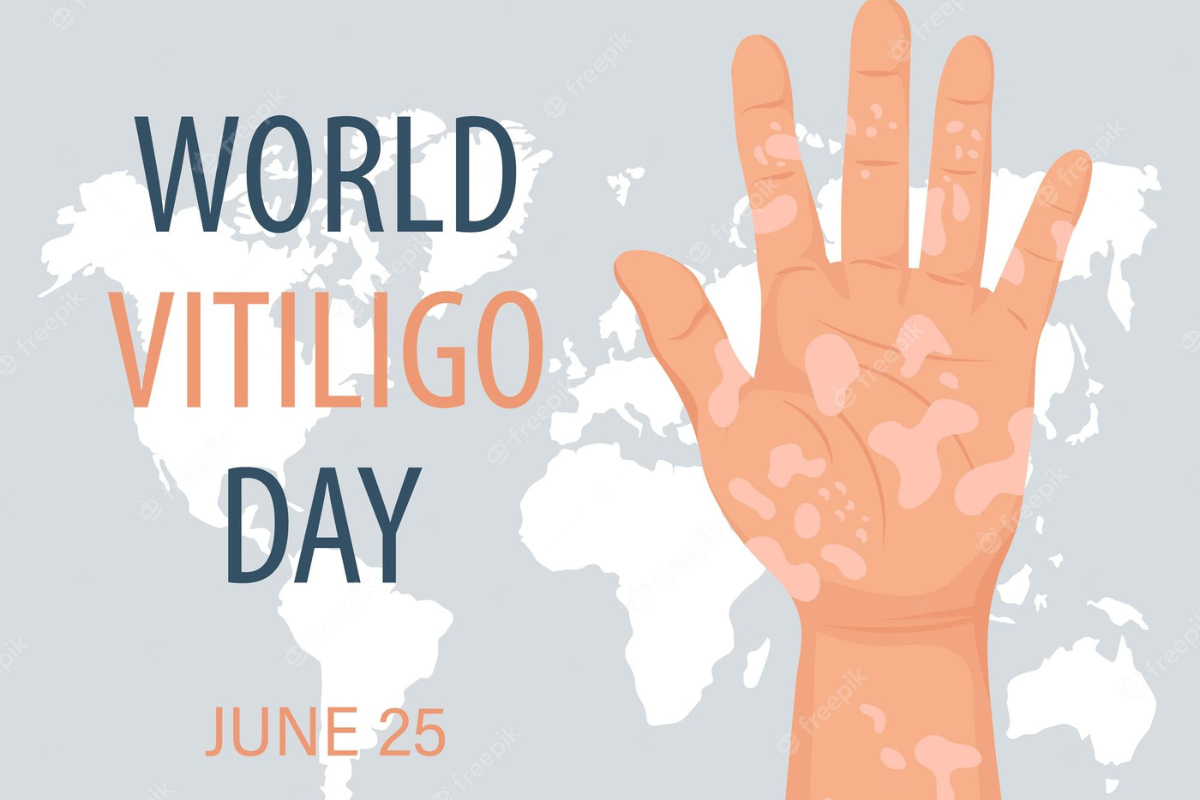World Vitiligo Day: आज मनाया जा रहा है विटिलिगो डे, जानें क्या है इसके लक्षण